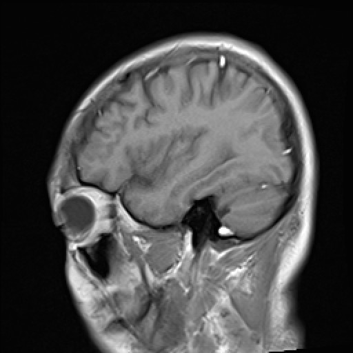 Click on the Study image to view the series of VILLANUEVA, WILLIAM A.